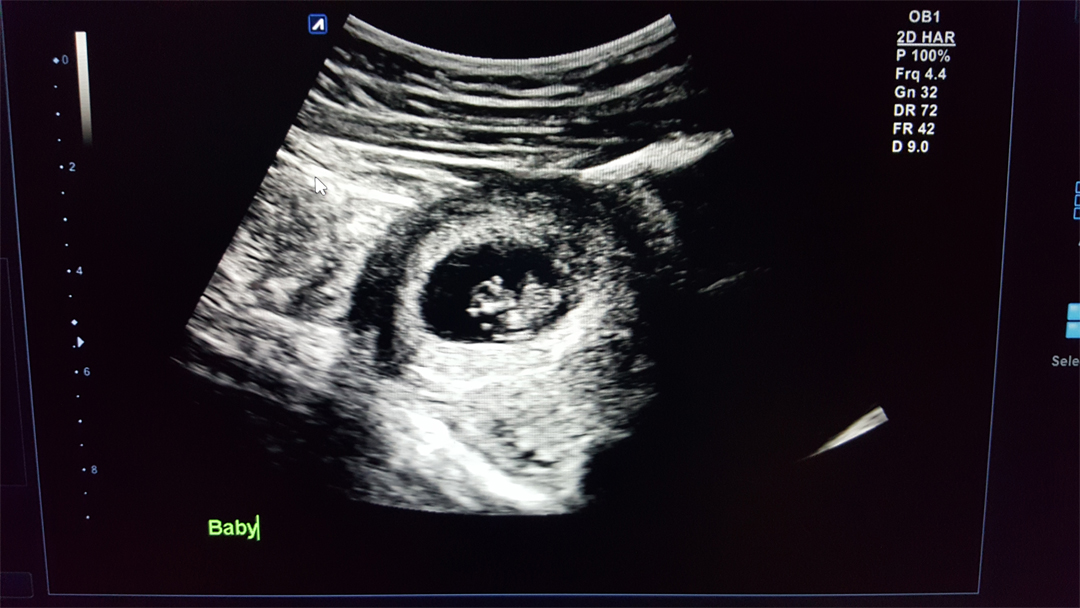 Name:  10week.jpg
Views: 199
Size:  378.1 KB