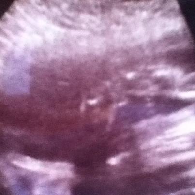 Name:  ultrasound.jpg
Views: 89
Size:  19.5 KB