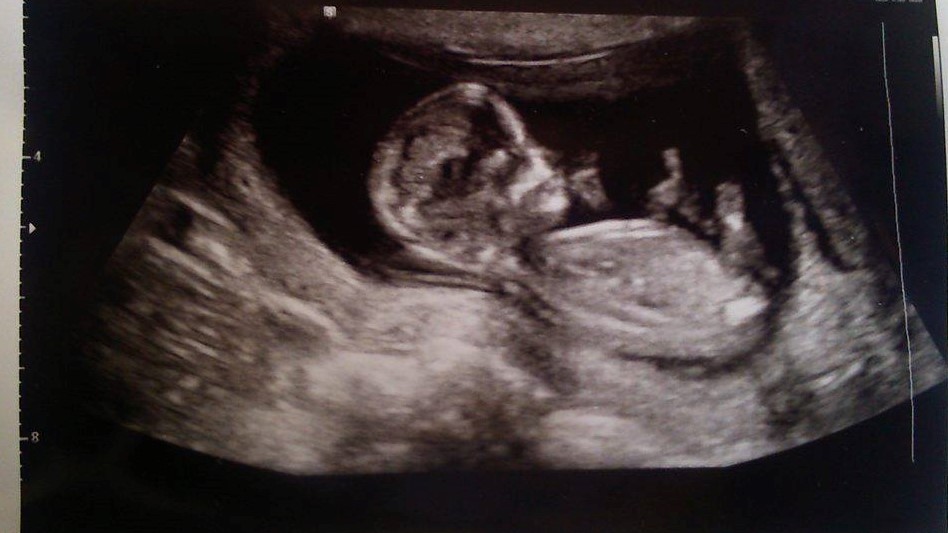 Name:  baby 3.jpg
Views: 515
Size:  109.0 KB