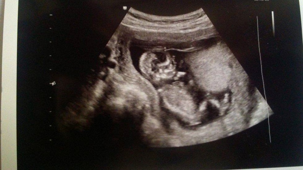 Name:  baby 4.jpg
Views: 278
Size:  125.9 KB