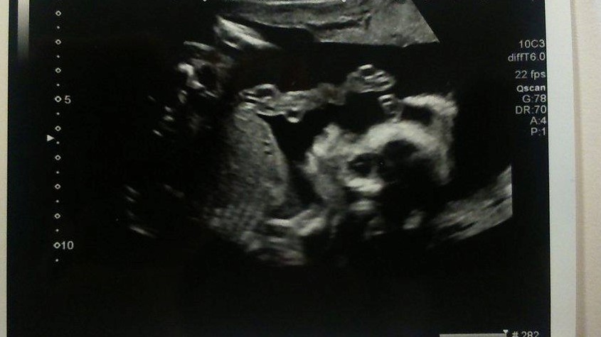 Name:  baby 1.jpg
Views: 217
Size:  80.6 KB