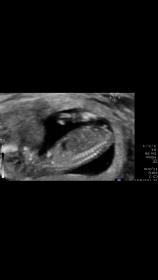Name:  IMG_4244.jpg
Views: 128
Size:  4.1 KB