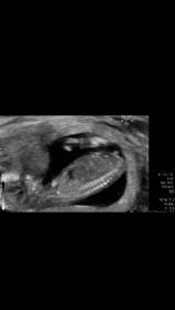 Name:  IMG_4256.jpg
Views: 113
Size:  3.9 KB