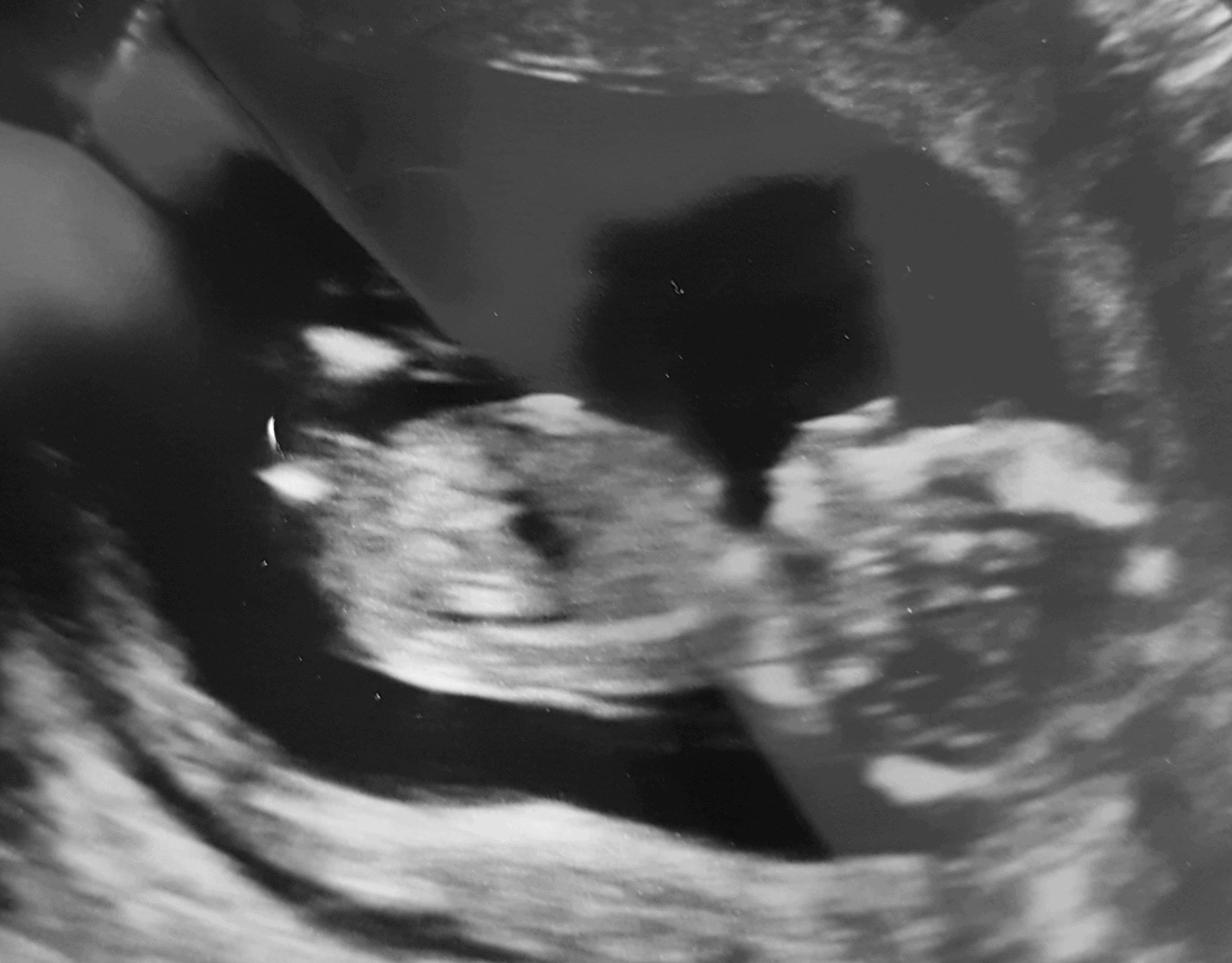 Name:  Baby6.jpg
Views: 418
Size:  404.3 KB
