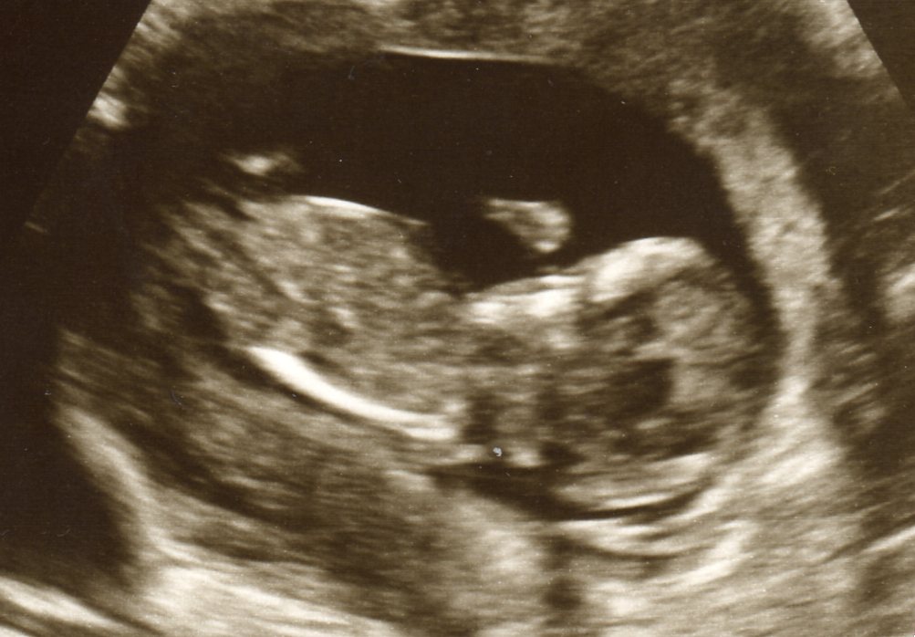 Name:  baby6n003.jpg
Views: 386
Size:  105.1 KB