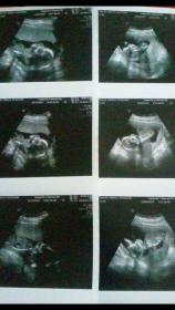 Name:  IMG_8105.jpg
Views: 138
Size:  9.3 KB