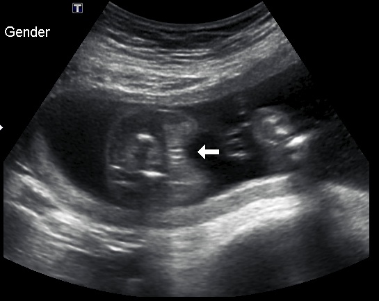 Name:  babygirl.jpg
Views: 104
Size:  52.7 KB