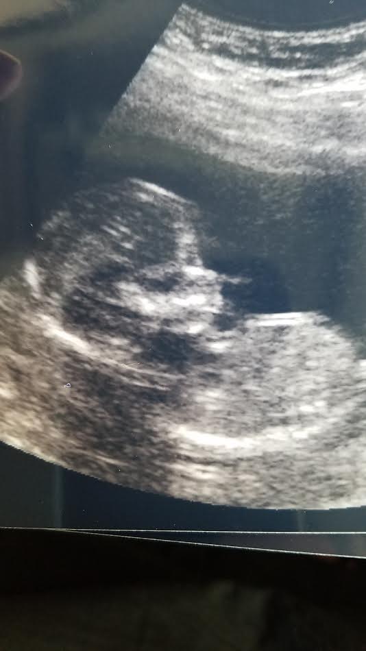 Name:  15 wk head.jpg
Views: 127
Size:  39.7 KB