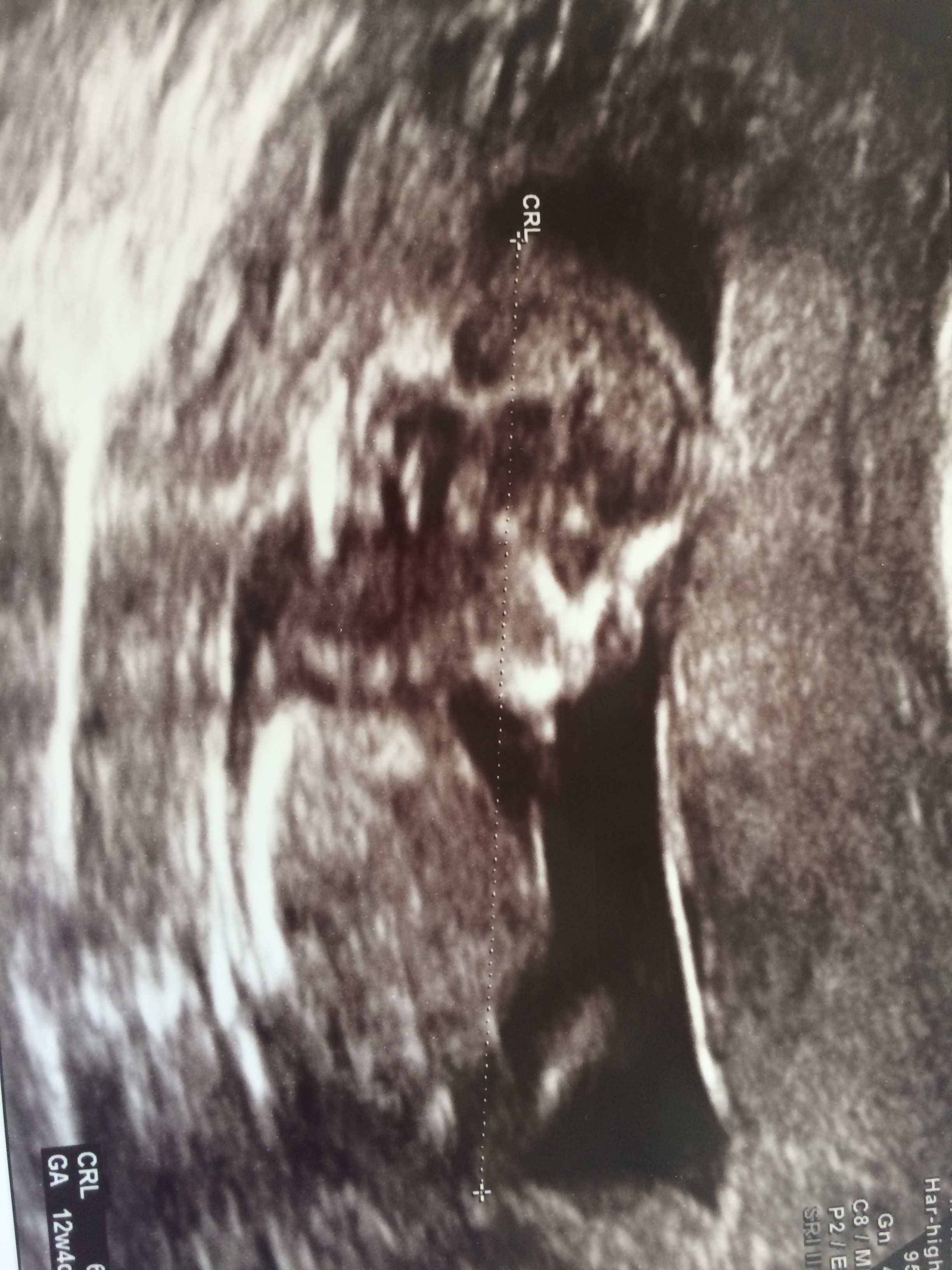 Name:  baby.JPG
Views: 435
Size:  1.45 MB