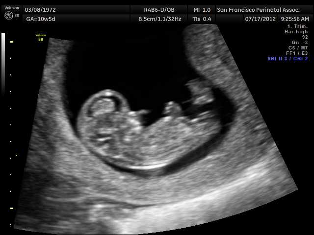 Name:  BABY 7-17-12_3.jpg
Views: 53663
Size:  91.6 KB