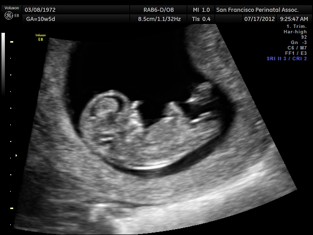 Name:  BABY 7-17-12_2.jpg
Views: 6320
Size:  91.2 KB