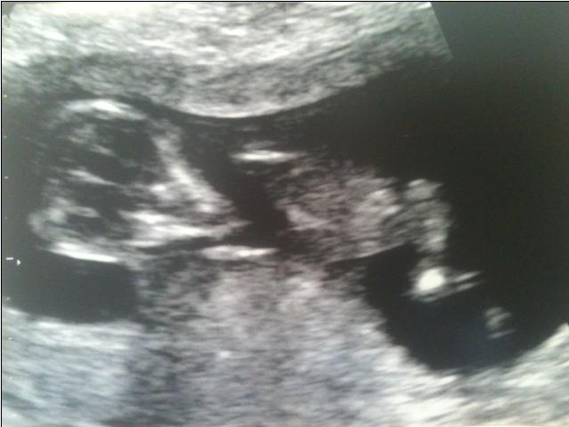 Name:  12 week pic.JPG
Views: 107
Size:  32.3 KB