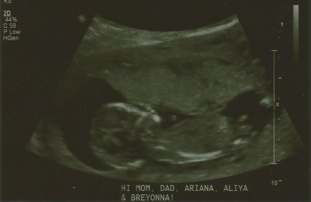 Name:  Sono 4.jpg
Views: 747
Size:  40.1 KB