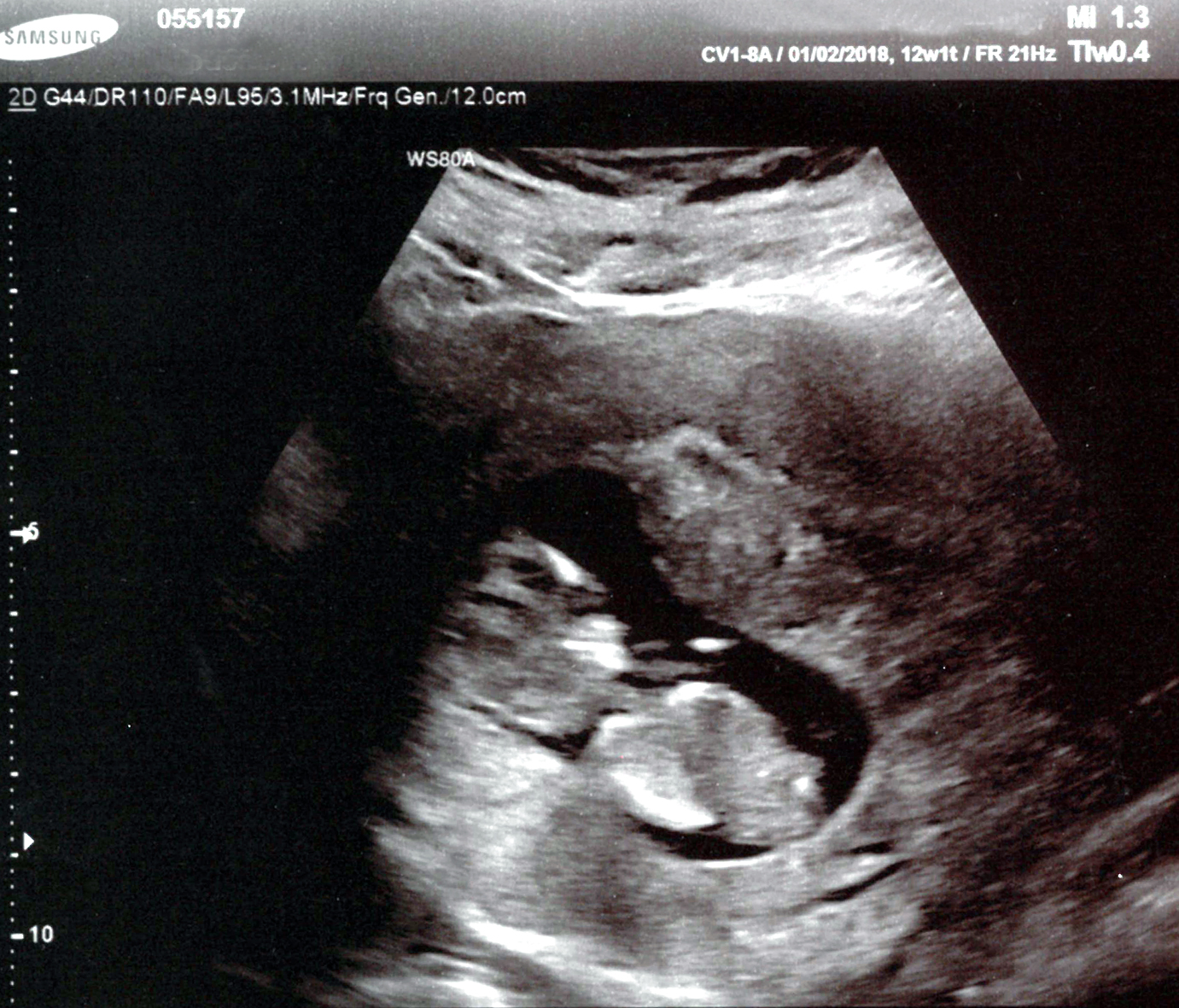 Name:  US3 - 2.jpg
Views: 183
Size:  1.04 MB
