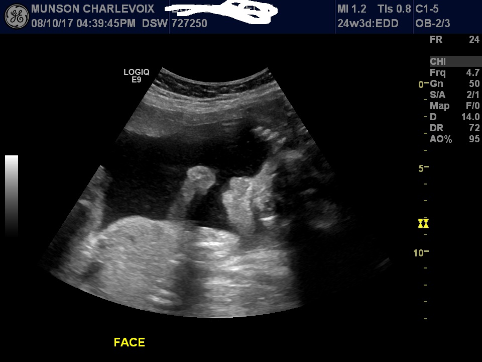 Name:  image 3 noname.jpg
Views: 462
Size:  112.0 KB