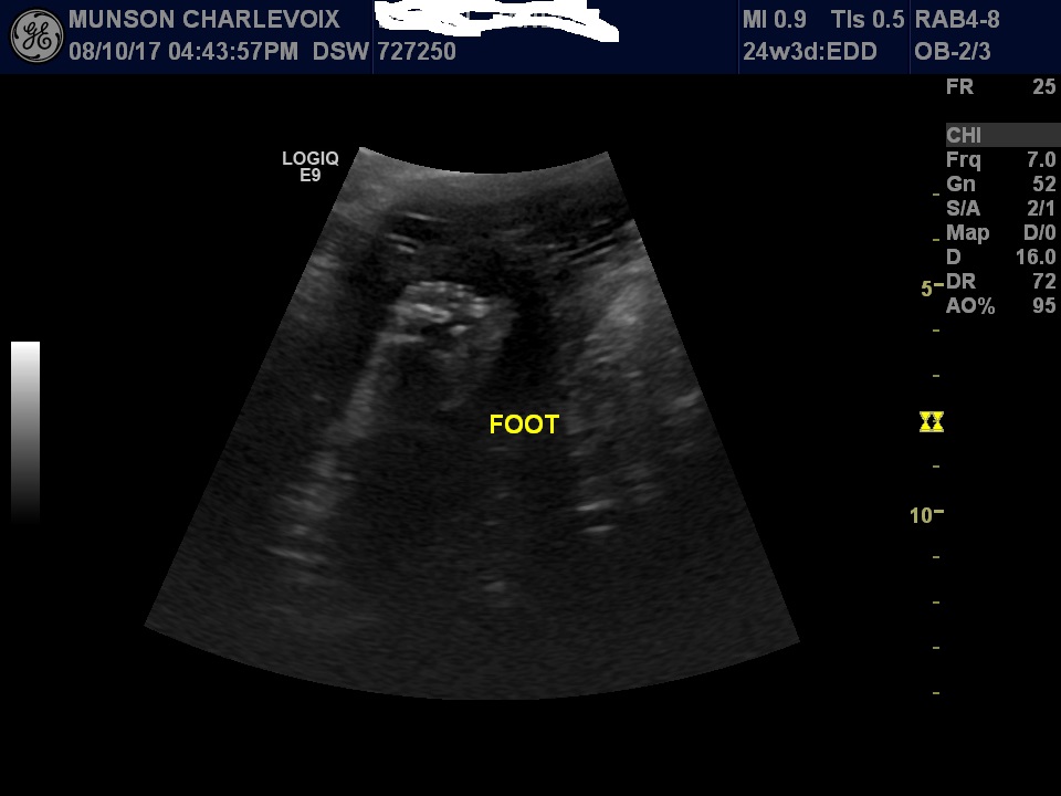 Name:  image 7noname.jpg
Views: 369
Size:  92.0 KB