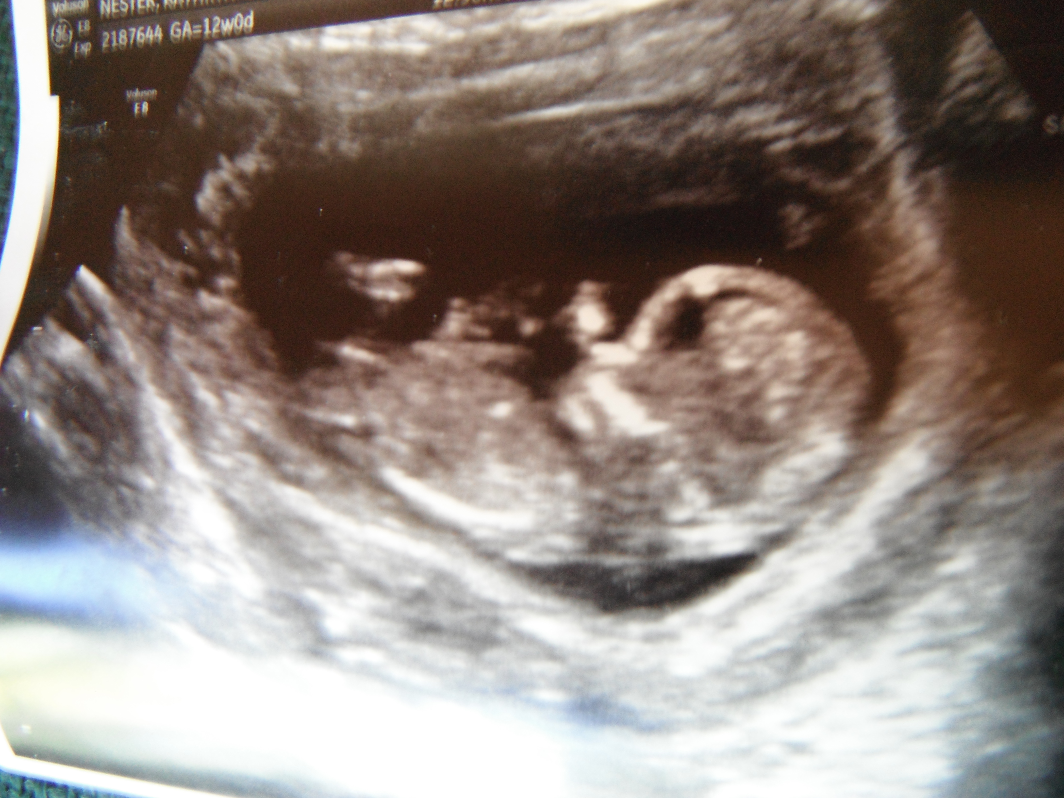 Name:  DSCF9164.JPG
Views: 1284
Size:  3.06 MB