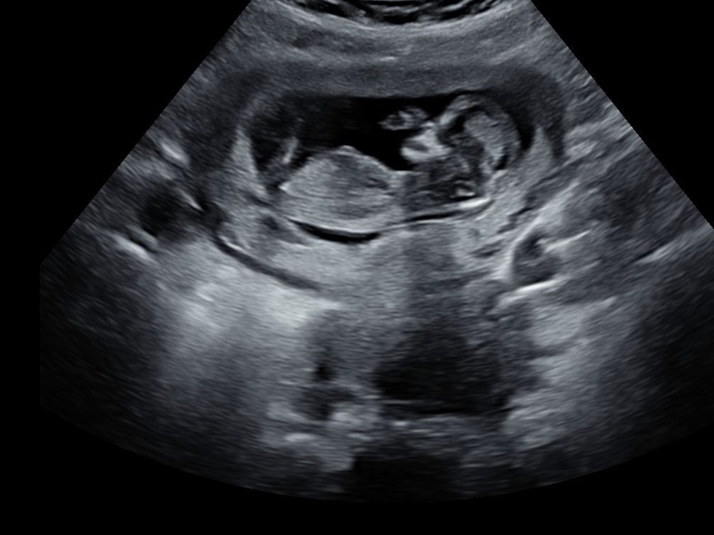 Name:  Ultrasound 1.JPG
Views: 425
Size:  120.4 KB