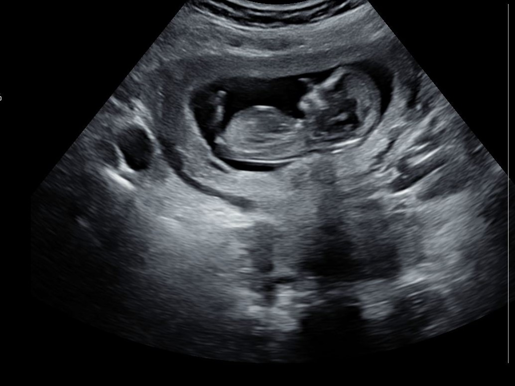 Name:  Ultrasound 2.JPG
Views: 776
Size:  132.2 KB