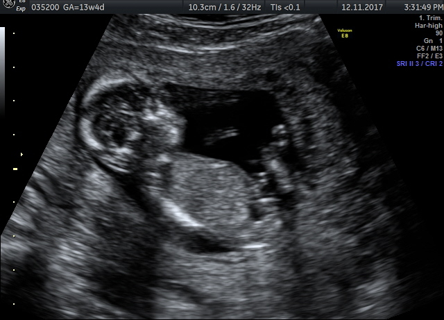 Name:  TO UP.jpg
Views: 410
Size:  133.2 KB