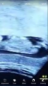 Name:  Screenshot_20171106-163431.jpg
Views: 185
Size:  7.7 KB