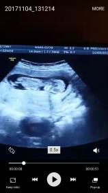 Name:  Screenshot_20171106-162538.jpg
Views: 178
Size:  7.5 KB