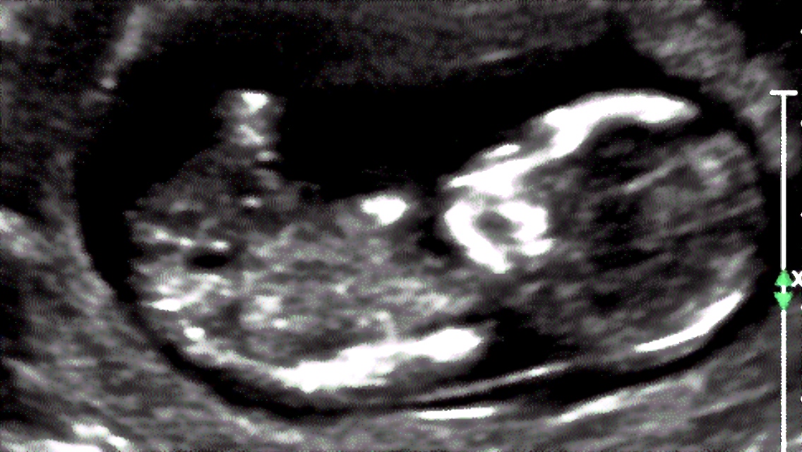 Name:  13w2d nub from video.jpg
Views: 361
Size:  303.3 KB