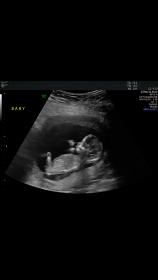 Name:  Screenshot_20171127-135455.jpg
Views: 166
Size:  3.8 KB
