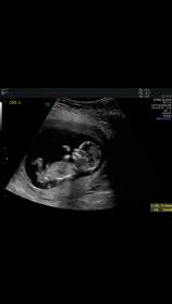 Name:  Screenshot_20171127-141741.jpg
Views: 162
Size:  3.9 KB