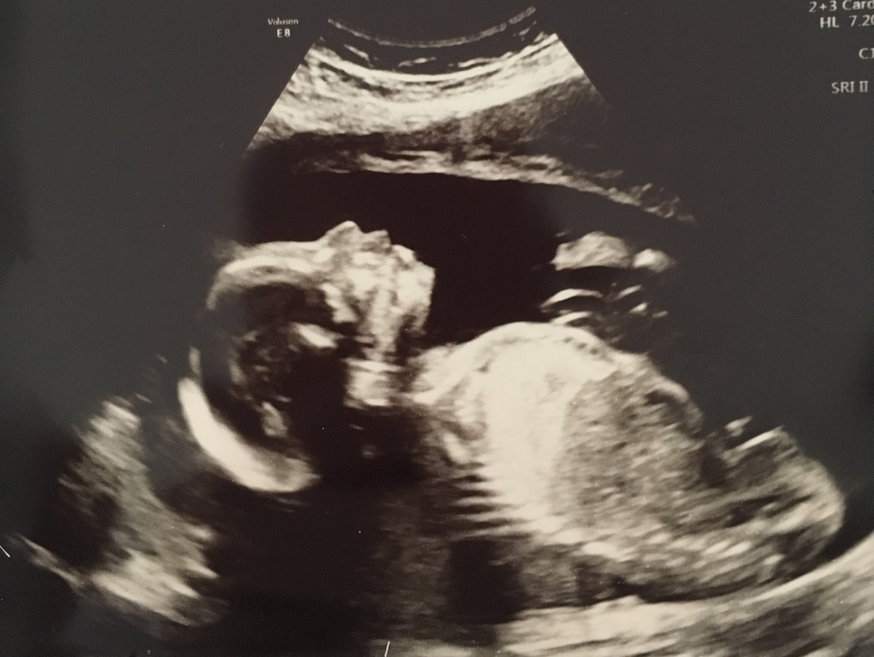 Name:  20 week2.jpg
Views: 228
Size:  1.08 MB