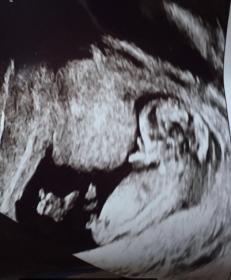 Name:  baby scan x.jpg
Views: 174
Size:  11.4 KB