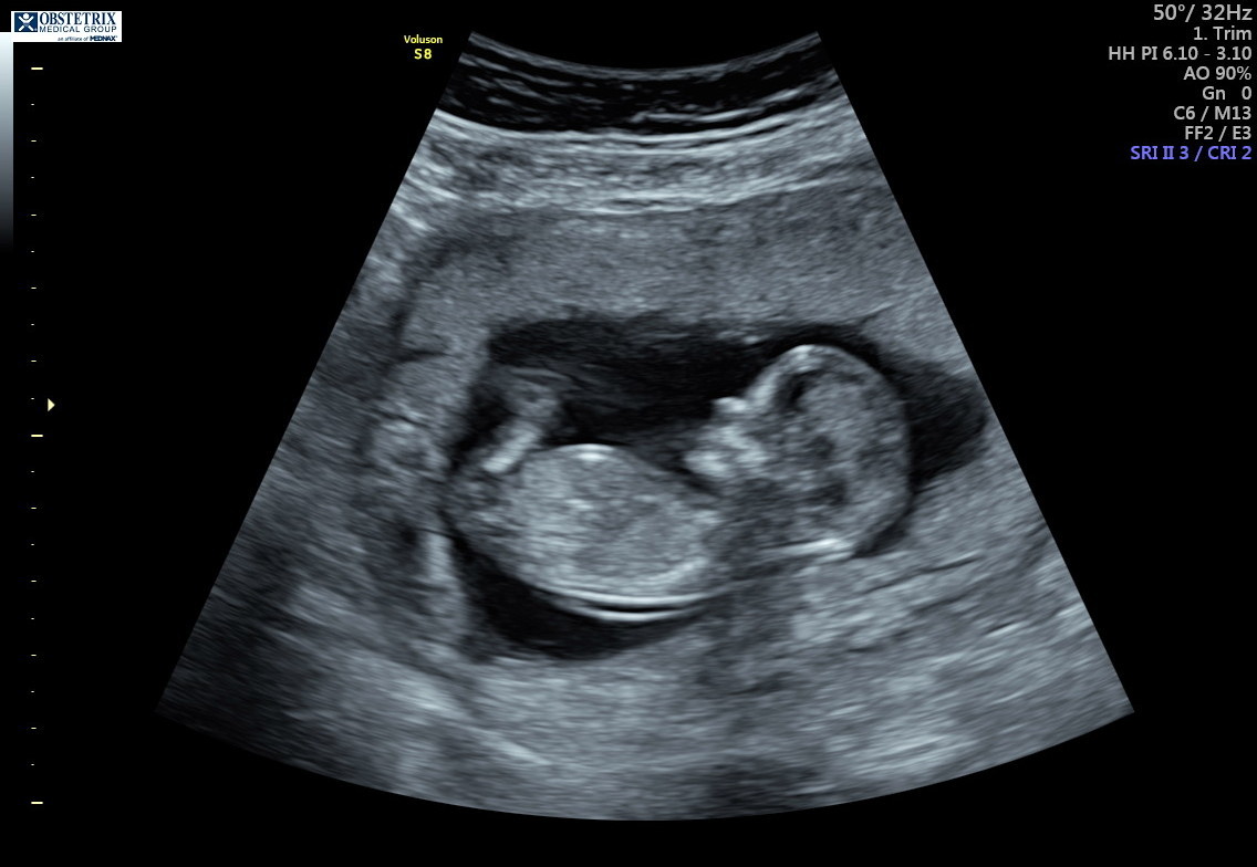 Name:  BabyCole#2(2).jpg
Views: 2228
Size:  119.5 KB