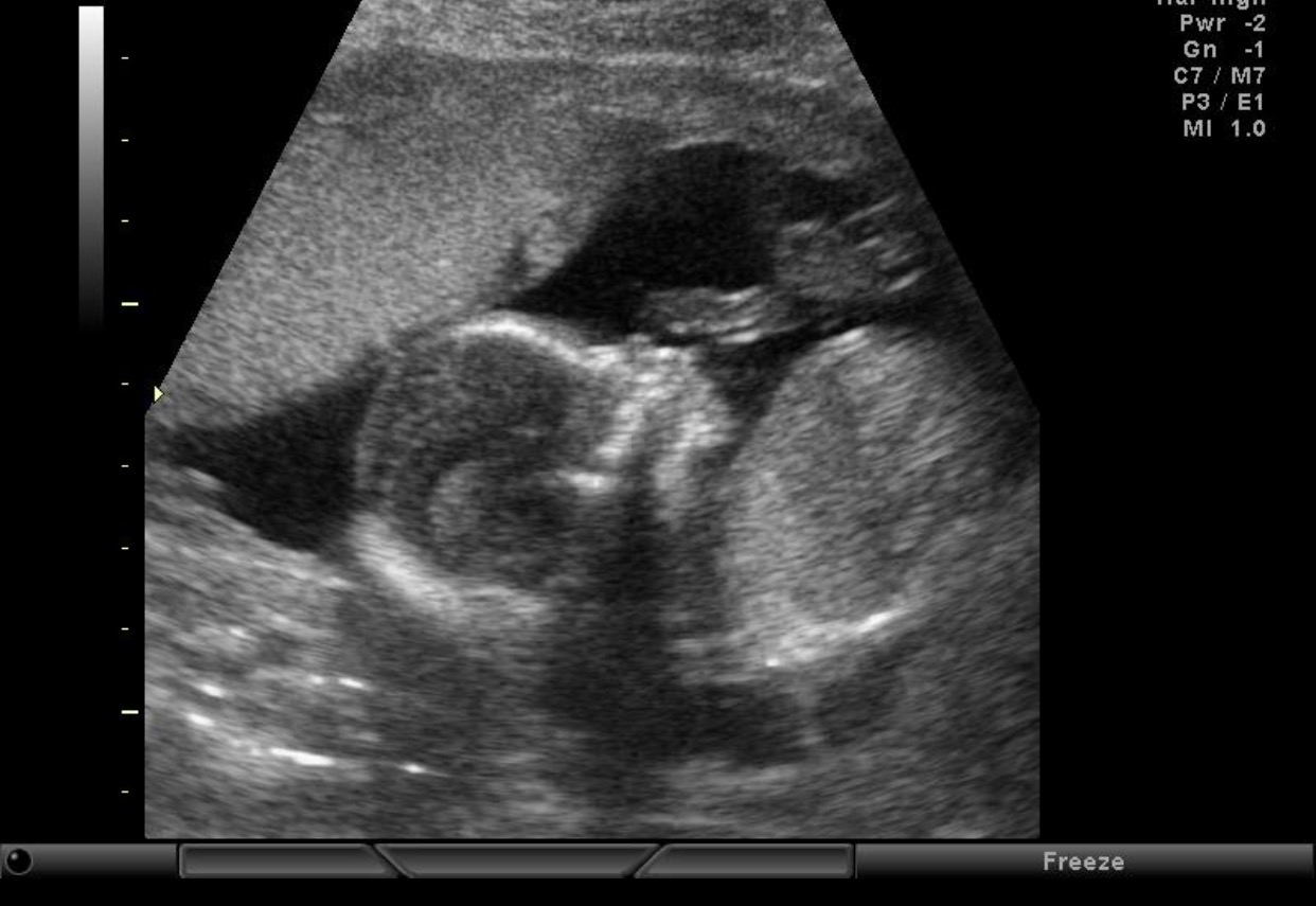 Name:  FullSizeRender (9).jpg
Views: 1347
Size:  143.0 KB