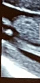 Name:  Screenshot_20180116-143312.jpg
Views: 113
Size:  6.9 KB