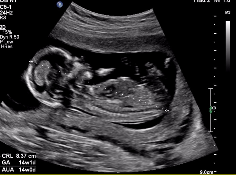Name:  Sagittal 1.jpg
Views: 672
Size:  108.9 KB