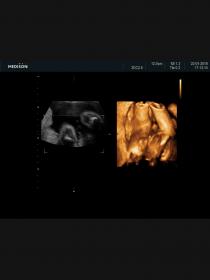 Name:  Screenshot_20180201-101038.jpg
Views: 274
Size:  4.5 KB