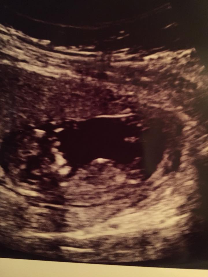 Name:  baby#2.jpg
Views: 126
Size:  56.5 KB
