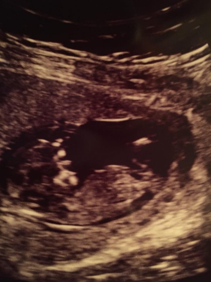 Name:  baby#2.1.jpg
Views: 160
Size:  55.0 KB