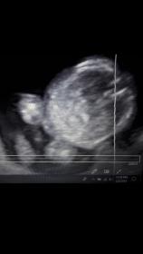 Name:  Screenshot_20180209-000558.jpg
Views: 185
Size:  4.6 KB