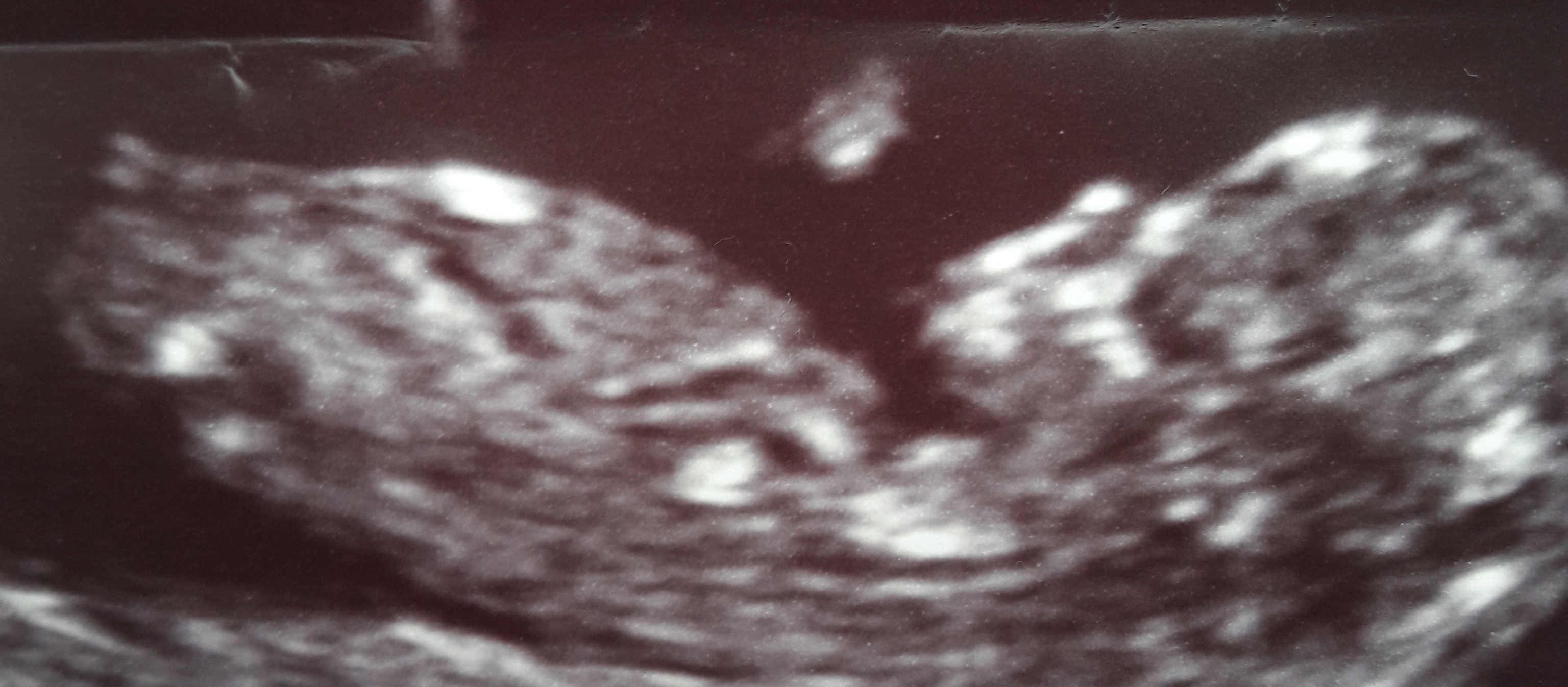 Name:  20180402_084231.jpg
Views: 321
Size:  1.92 MB