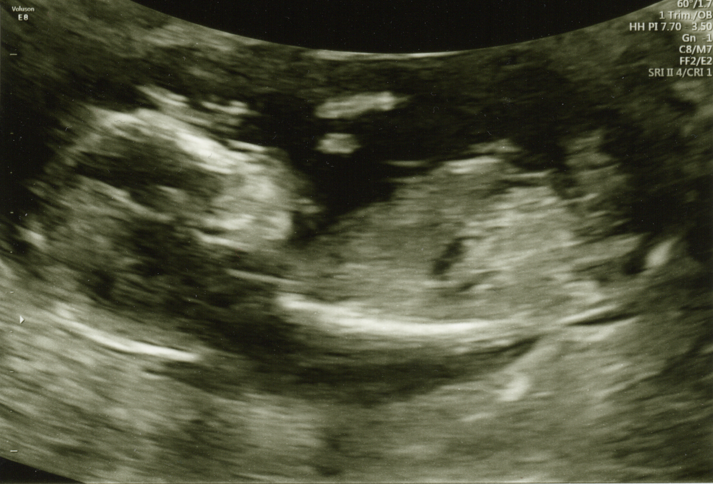 Name:  scan 2.jpg
Views: 166
Size:  1.92 MB