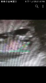 Name:  Screenshot_20180520-134158.jpg
Views: 173
Size:  5.7 KB