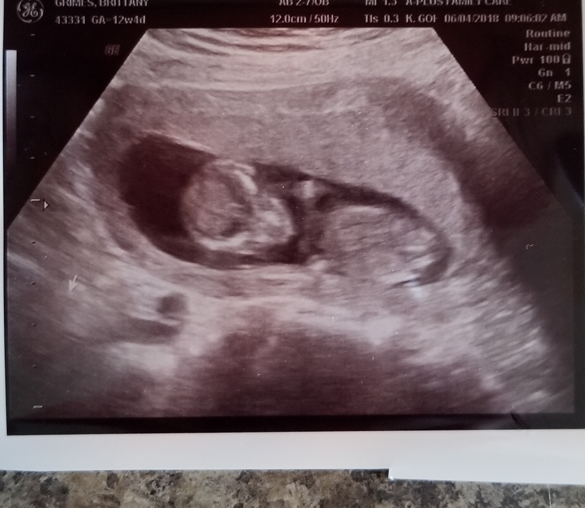 Name:  12wk4d.jpg
Views: 595
Size:  1.43 MB