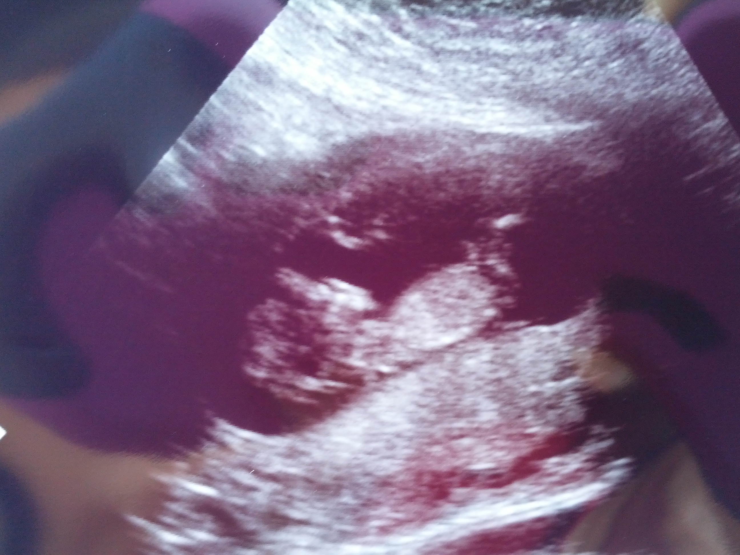 Name:  12 wks 4 days.jpg
Views: 683
Size:  1.44 MB