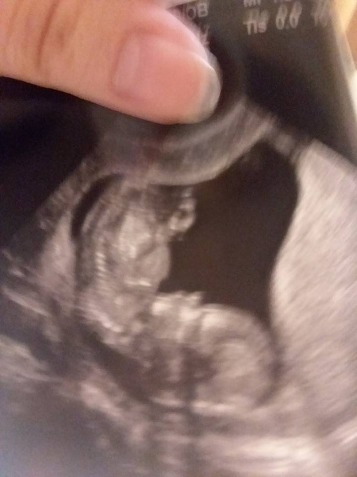 Name:  baby 2019.jpg
Views: 105
Size:  44.3 KB