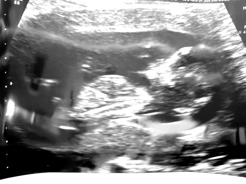 Name:  20181022_080553_second.jpg
Views: 109
Size:  151.8 KB