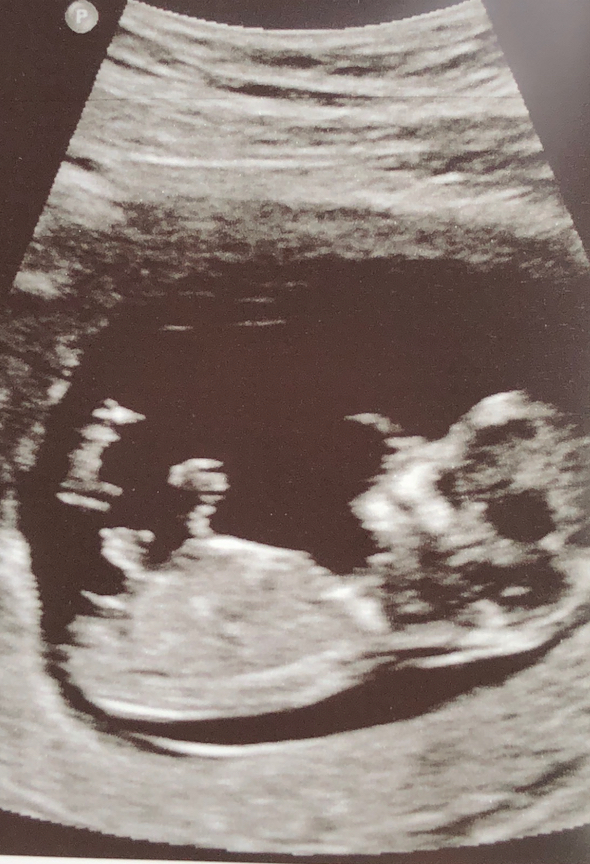 Name:  12 Week Ultrasound.jpg
Views: 190
Size:  547.1 KB