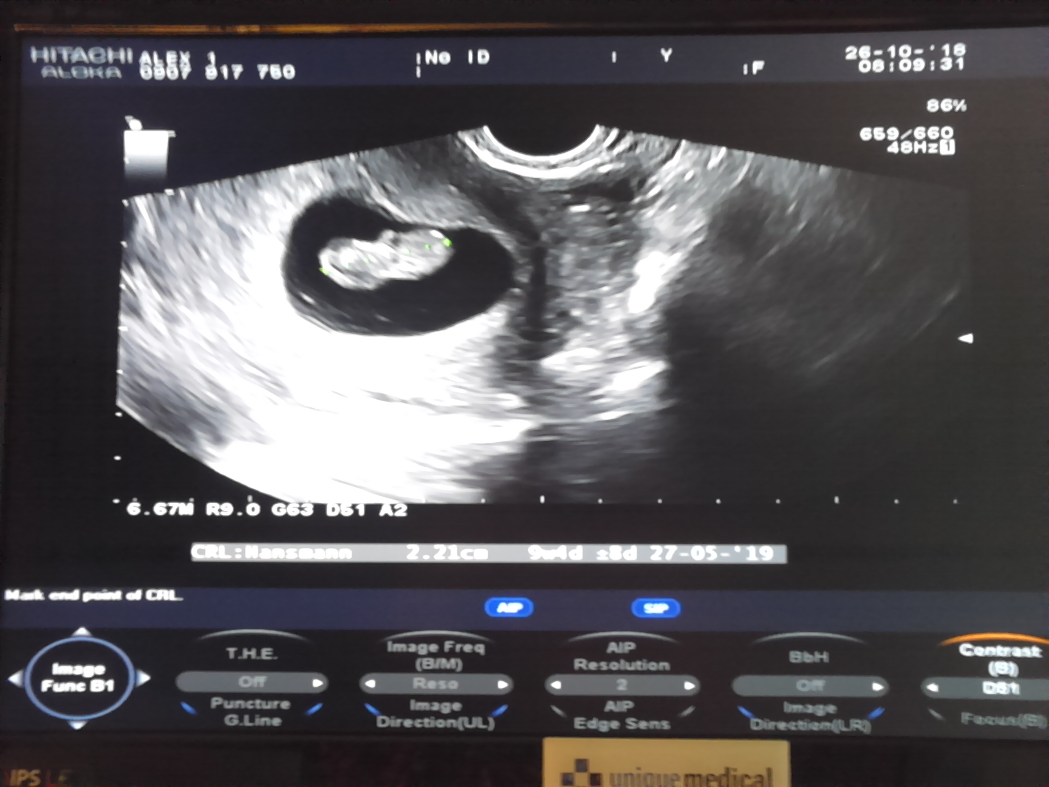 Name:  Baby sono 26.10.2018.JPG
Views: 94
Size:  578.6 KB
