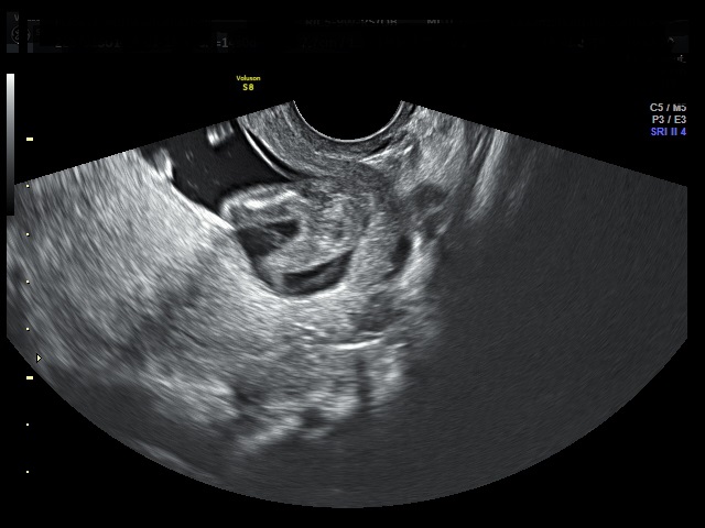 Name:  potty shot 14 weeks.jpg
Views: 121
Size:  74.7 KB
