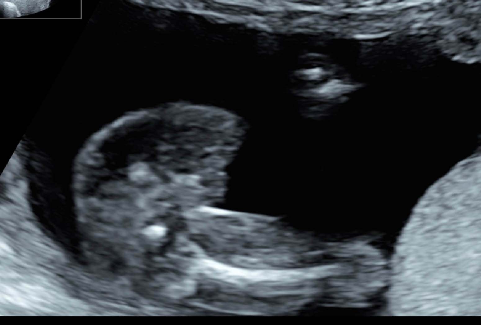 Name:  ULTRASOUND2.jpg
Views: 1306
Size:  111.7 KB